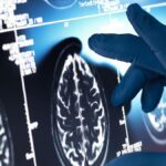 Becas impulsan investigación Alzheimer LATAM